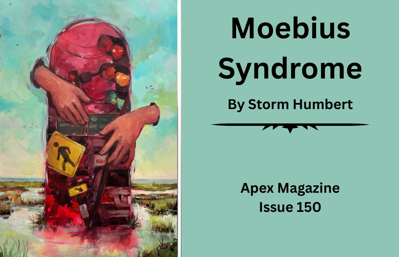 Moebius Syndrome